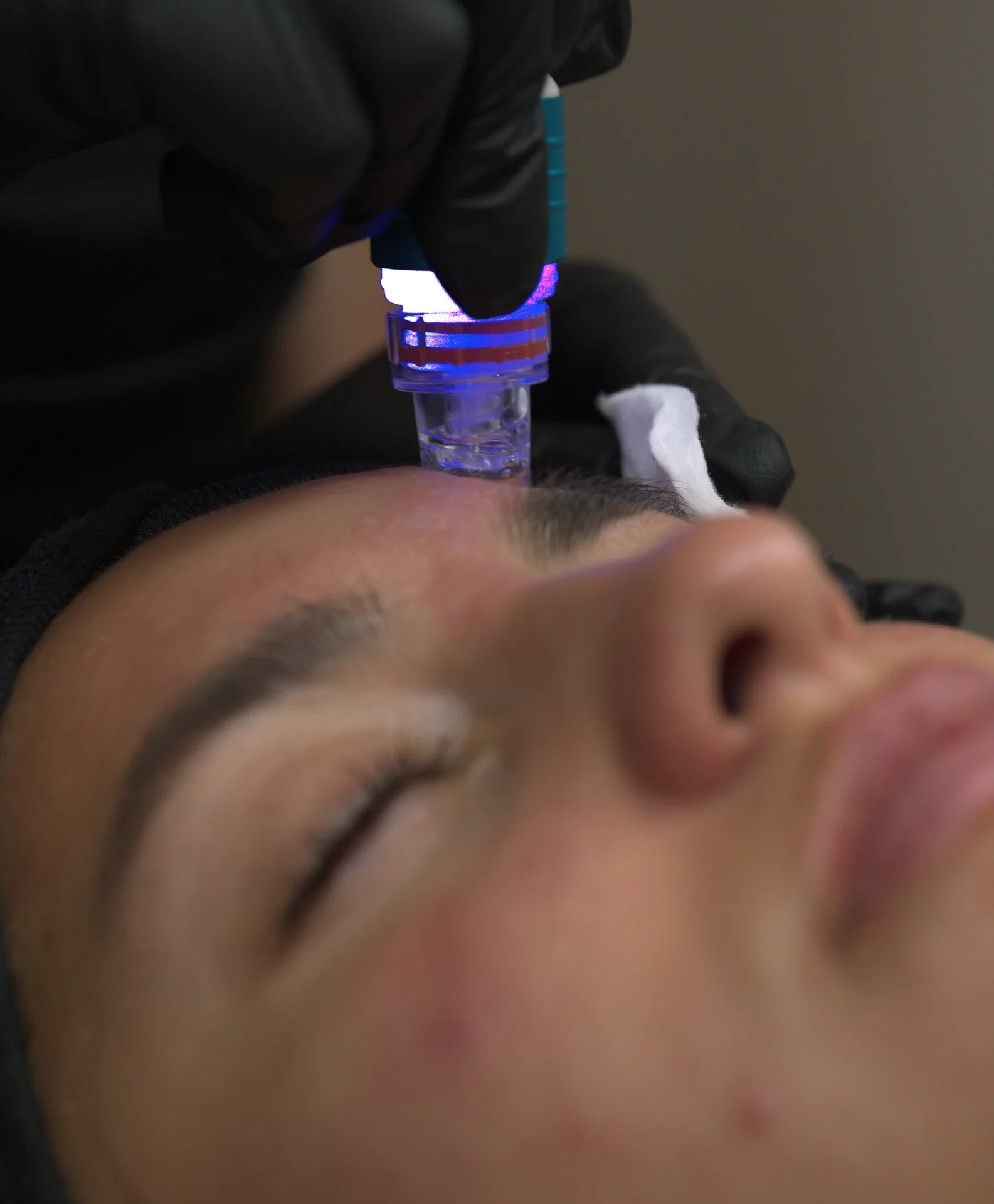 Soin visage professionnel